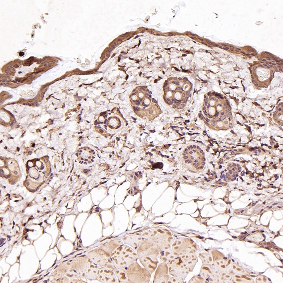 m01577 1 ihc11