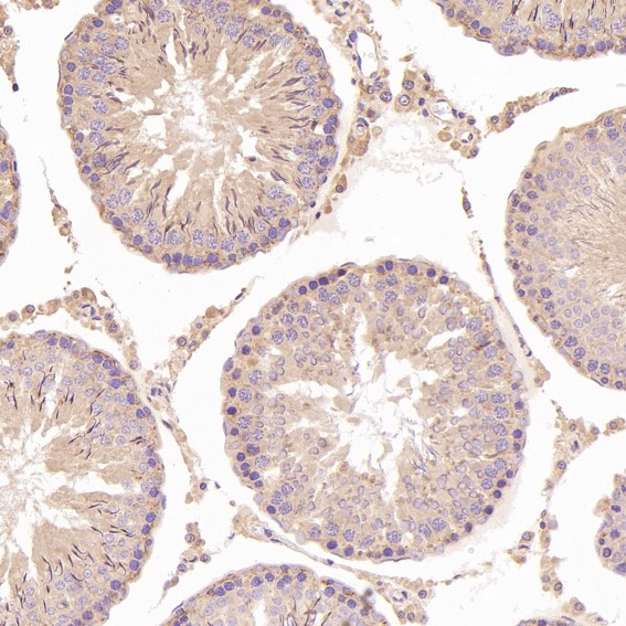 Immunohistochemical analysis of paraffin-embedded Rat testis, using the Antibody at 1:100 dilution