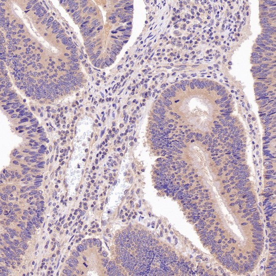 m01577 1 ihc9