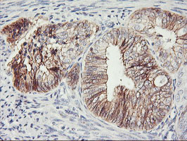 m01577 3 anti n cadherin cdh2 mouse monoclonal antibody clone id oti2g7 ihc testing 6