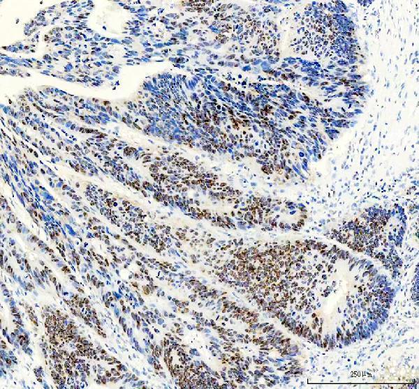  IHC analysis of CUL4A using anti-CUL4A antibody (M01579)