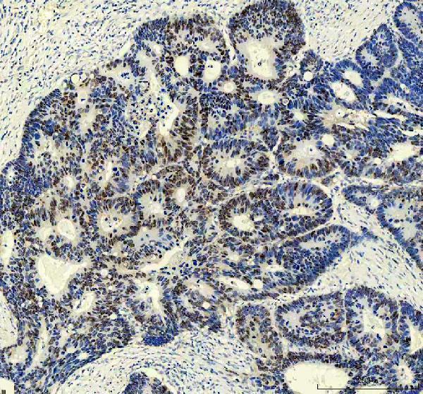  IHC analysis of CUL4A using anti-CUL4A antibody (M01579)