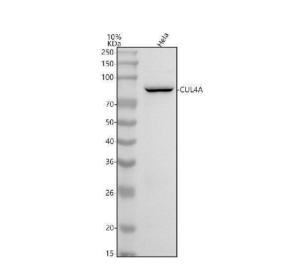  Western blot analysis of Cullin4A using anti-Cullin4A antibody (M01579)
