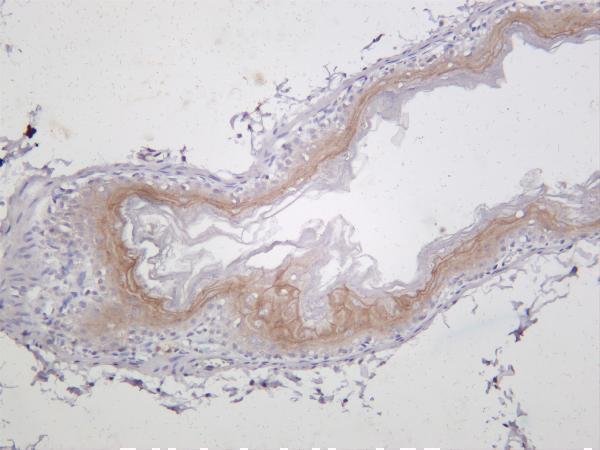 Mouse stomach was stained with anti-Claudin 1 rabbit antibody