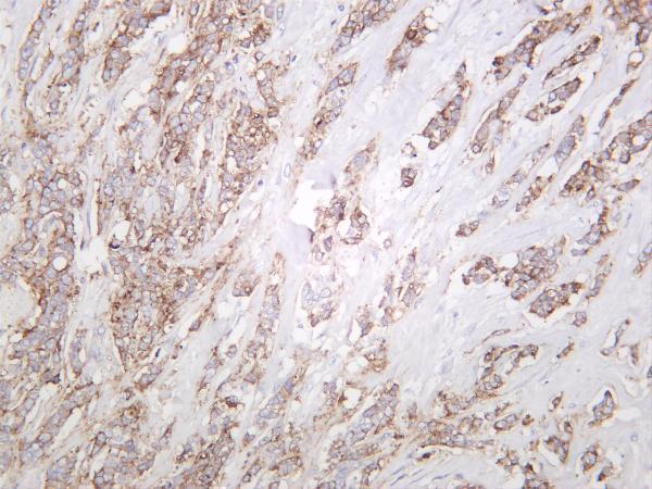 Human breast was stained with anti-Claudin 1 rabbit antibody
