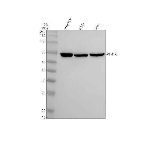 Western blot analysis of PTH1R using anti-PTH1R antibody (M01588)