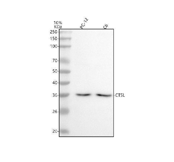  Western blot analysis of Cathepsin L/V/K/H using anti-Cathepsin L/V/K/H antibody (M01589)