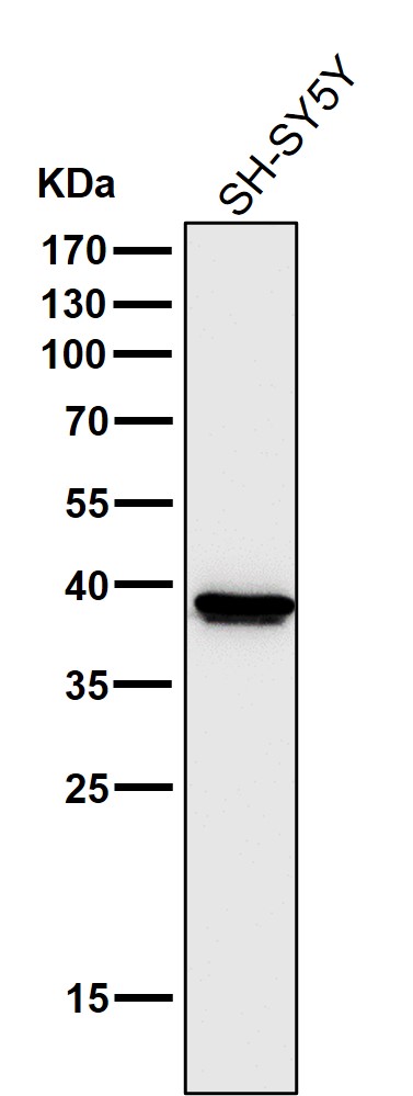 All lanes use the Antibody at 1:5K dilution for 1 hour at room temperature