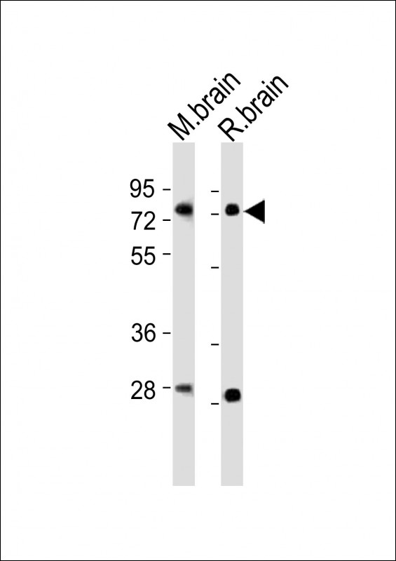 All lanes : Anti-Nr4a2 Antibody (Center) at 1:2000 dilution Lane 1: mouse brain lysates Lane 2: rat brain lysates Lysates/proteins at 20 microg per lane. Secondary Goat Anti-Rabbit IgG, (H+L), Peroxidase conjugated at 1/10000 dilution Predicted band size : 67 kDa Blocking/Dilution buffer: 5% NFDM/TBST.