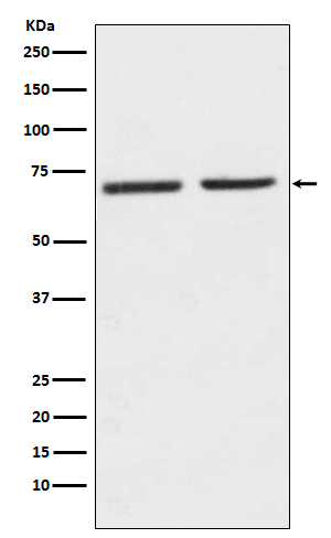 Western blot analysis of 5HT2C Receptor expression in (1) SH-SY5Y cell lysate; (2) Mouse kidney lysate