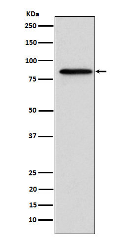 Western blot analysis of Gelsolin expression in A431 cell lysate