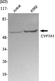 m01601 cyp7a1 primary antibodies wb testing 1