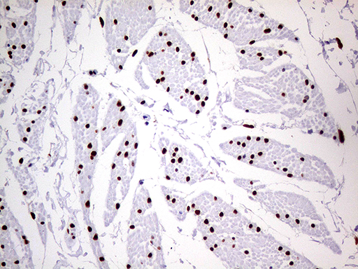 m01602 1 anti meis1 mouse monoclonal antibody clone id oti2a3 ihc testing 10