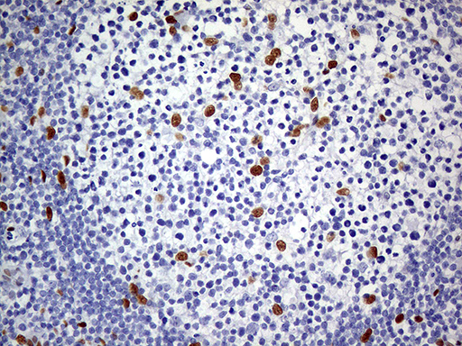 m01602 1 anti meis1 mouse monoclonal antibody clone id oti2a3 ihc testing 11