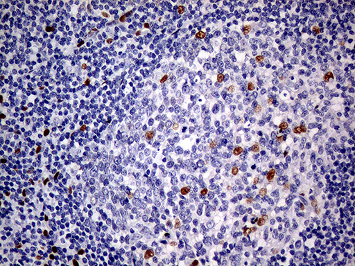 m01602 1 anti meis1 mouse monoclonal antibody clone id oti2a3 ihc testing 12