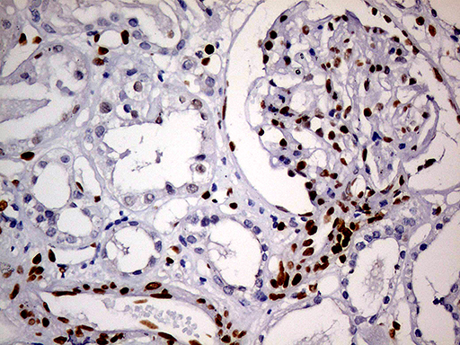 m01602 1 anti meis1 mouse monoclonal antibody clone id oti2a3 ihc testing 13