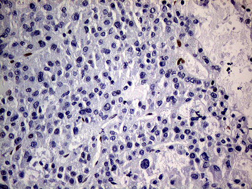 m01602 1 anti meis1 mouse monoclonal antibody clone id oti2a3 ihc testing 14