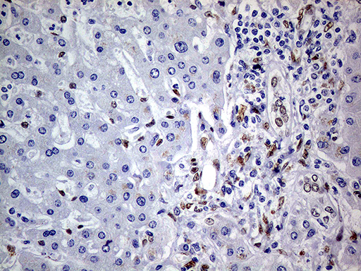 m01602 1 anti meis1 mouse monoclonal antibody clone id oti2a3 ihc testing 15