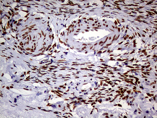 Immunohistochemical staining of paraffin-embedded Human Ovary tissue within the normal limits using anti-MEIS1 mouse monoclonal antibody