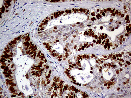 m01602 1 anti meis1 mouse monoclonal antibody clone id oti2a3 ihc testing 4