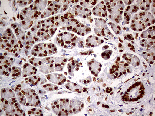m01602 1 anti meis1 mouse monoclonal antibody clone id oti2a3 ihc testing 5