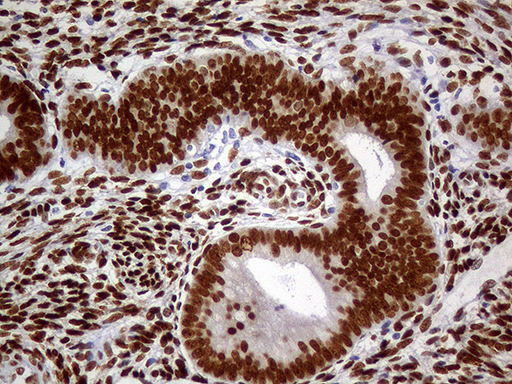m01602 1 anti meis1 mouse monoclonal antibody clone id oti2a3 ihc testing 6