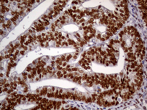 m01602 1 anti meis1 mouse monoclonal antibody clone id oti2a3 ihc testing 7