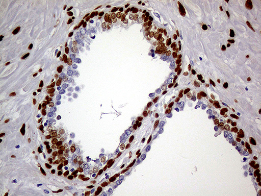 m01602 1 anti meis1 mouse monoclonal antibody clone id oti2a3 ihc testing 8