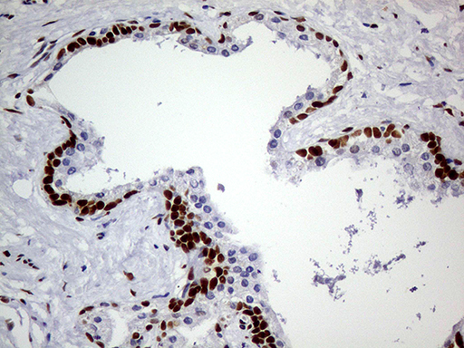 m01602 1 anti meis1 mouse monoclonal antibody clone id oti2a3 ihc testing 9