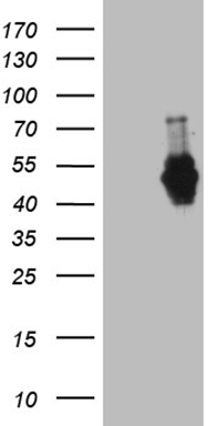 HEK293T cells were transfected with the pCMV6-ENTRY control (Left lane) or pCMV6-ENTRY MEIS1 (Right lane) cDNA for 48 hrs and lysed