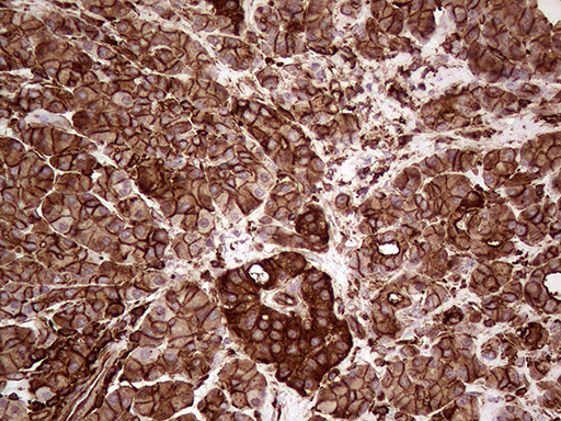 m01603 1 anti iqgap1 mouse monoclonal antibody clone id oti5f9 ihc testing 3
