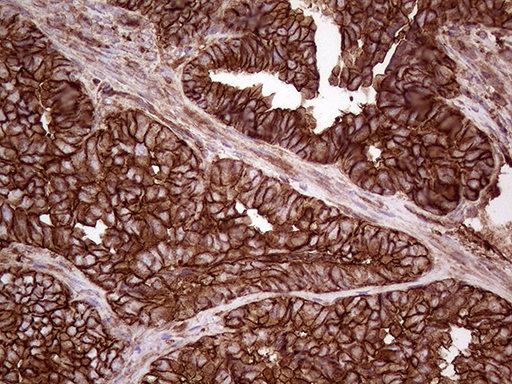 m01603 1 anti iqgap1 mouse monoclonal antibody clone id oti5f9 ihc testing 4