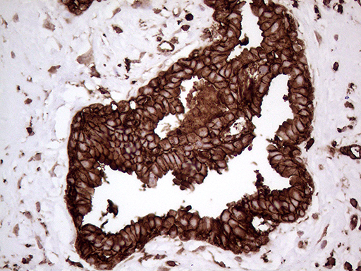 m01603 1 anti iqgap1 mouse monoclonal antibody clone id oti5f9 ihc testing 5