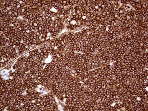 m01603 1 anti iqgap1 mouse monoclonal antibody clone id oti5f9 ihc testing 6