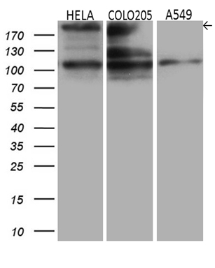 m01603 1 anti iqgap1 mouse monoclonal antibody clone id oti5f9 wb testing 2
