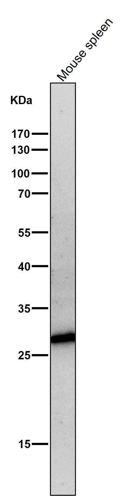 All lanes use the Antibody at 1:5K dilution for 1 hour at room temperature.