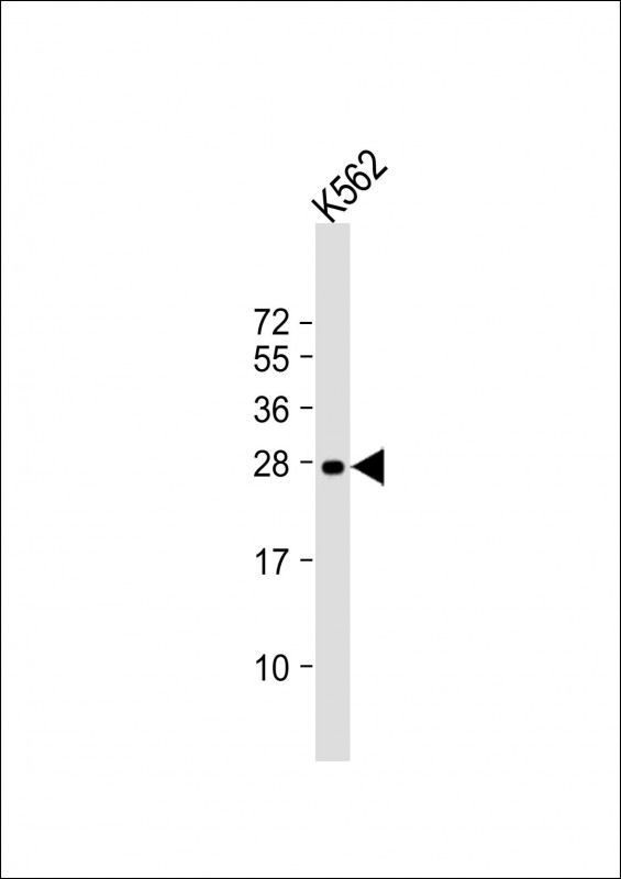 m01608 1 anti rab27a antibody wb testing 1