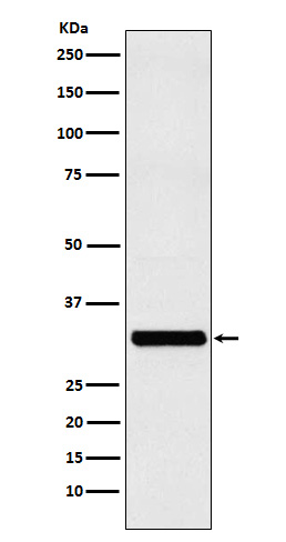 Western blot analysis of RAB27A expression in MCF-7 cell lysate