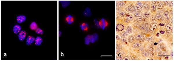 m01610 tpx2 primary antibodies icc testing 2