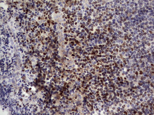 m01611 1 anti ikzf3 mouse monoclonal antibody clone id oti7e11 ihc testing 4