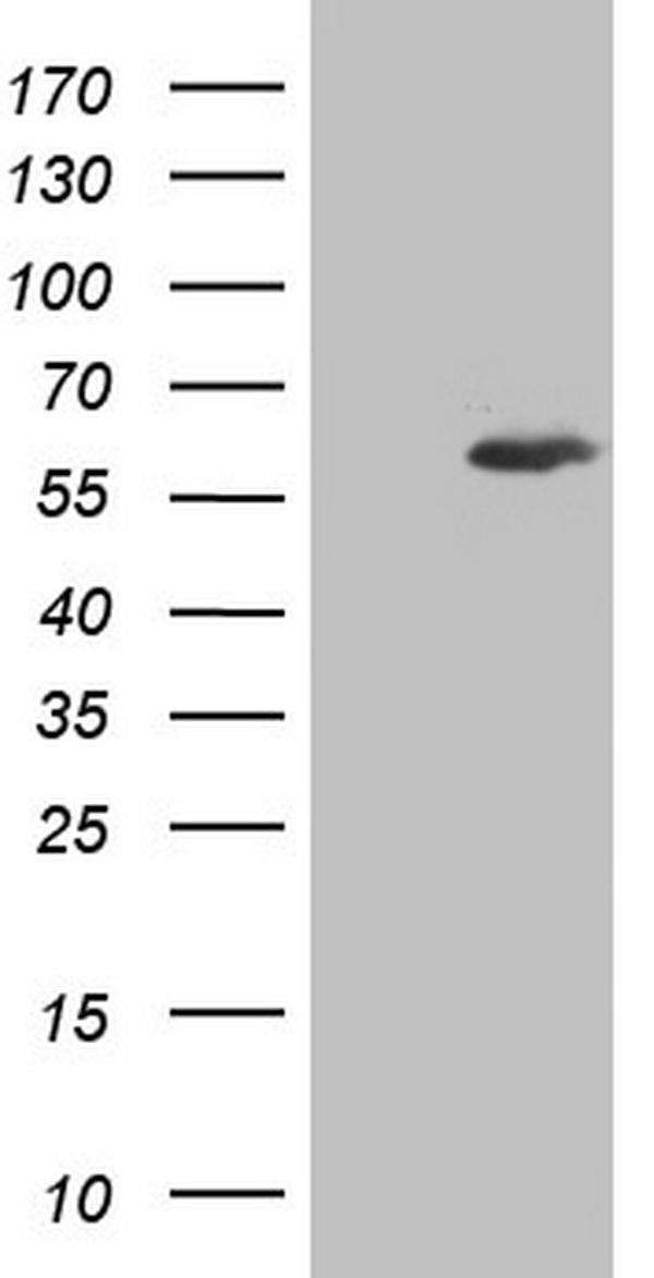 HEK293T cells were transfected with the pCMV6-ENTRY control (Left lane) or pCMV6-ENTRY IKZF3 (Right lane) cDNA for 48 hrs and lysed