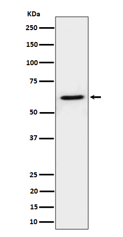 Western blot analysis of IKZF3 expression in Raji cell lysate
