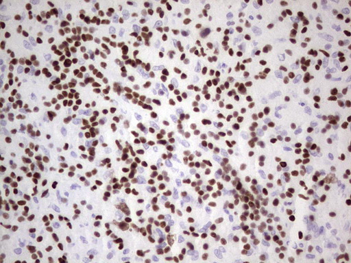 Immunohistochemical staining of paraffin-embedded Human lymph node tissue within the normal limits using anti-IKZF3 mouse monoclonal antibody
