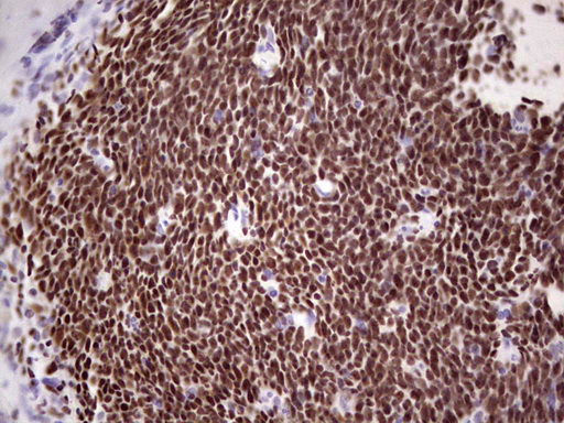 m01611 anti ikzf3 mouse monoclonal antibody clone id oti4h7 ihc testing 4