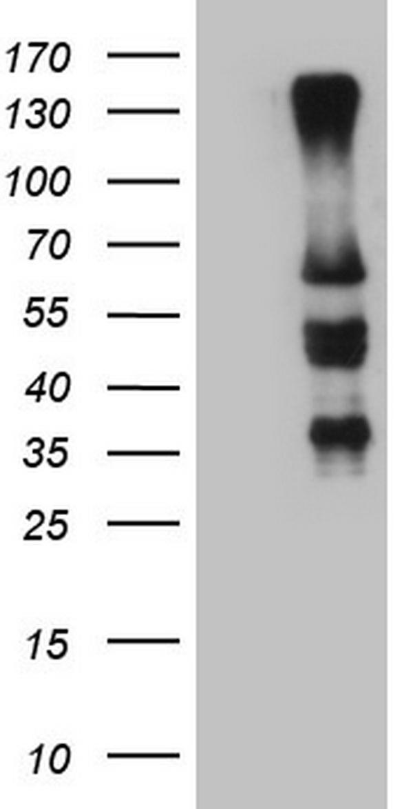 HEK293T cells were transfected with the pCMV6-ENTRY control (Left lane) or pCMV6-ENTRY IKZF3 (Right lane) cDNA for 48 hrs and lysed