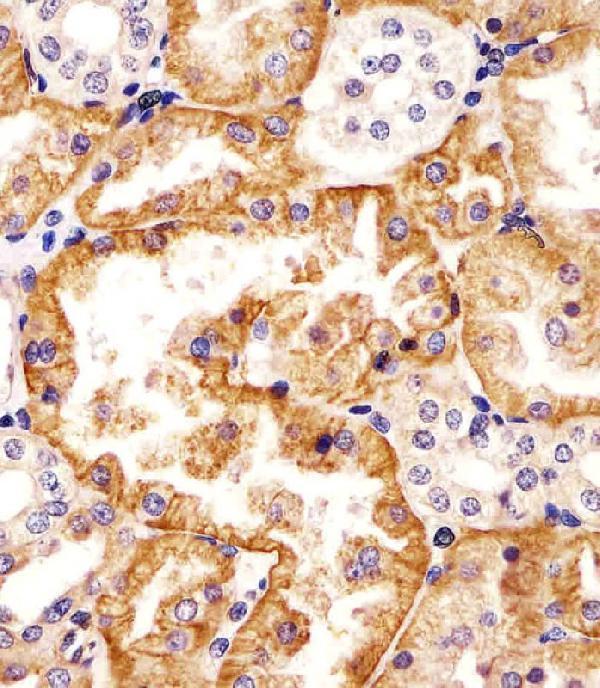 M01612 staining SLC22A2 in human kidney tissue sections by Immunohistochemistry (IHC-P -paraformaldehyde-fixed, paraffin-embedded sections)