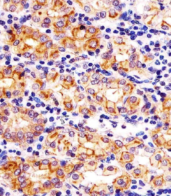 M01612 staining SLC22A2 in human stomach tissue sections by Immunohistochemistry (IHC-P -paraformaldehyde-fixed, paraffin-embedded sections)