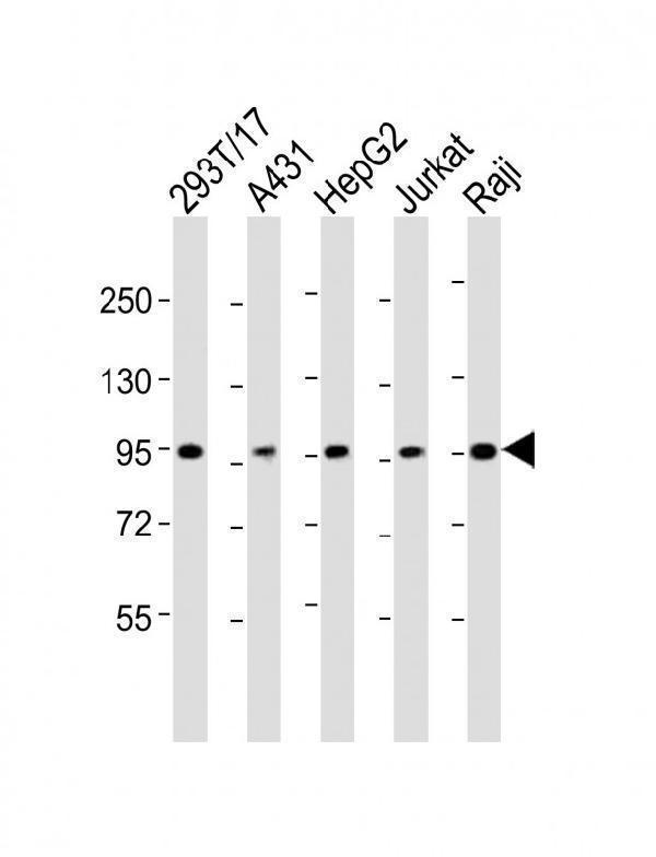 All lanes : Anti-SLC22A2 Antibody (N-term) at 1:2000 dilutionLane 1: 293T/17 whole cell lysateLane 2: A431 whole cell lysateLane 3: HepG2 whole cell lysateLane 4: Jurkat whole cell lysateLane 5: Raji whole cell lysateLysates/proteins at 20 µg per lane