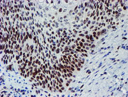 m01615 1 anti slug snai2 mouse monoclonal antibody clone id oti1a6 ihc testing 6