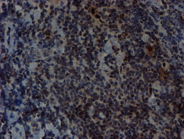 m01615 1 anti slug snai2 mouse monoclonal antibody clone id oti1a6 ihc testing 7
